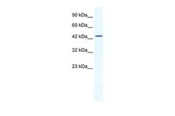 Anti-DMRTB1 antibody, Internal used in Western Blot (WB). GTX48963