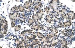 Anti-DHX9 antibody, N-term used in IHC (Paraffin sections) (IHC-P). GTX48966