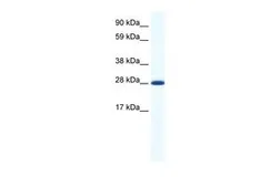 Anti-DLX4 antibody, N-term used in Western Blot (WB). GTX48970