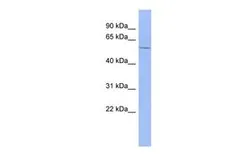 Anti-DACH1 antibody, N-term used in Western Blot (WB). GTX49004