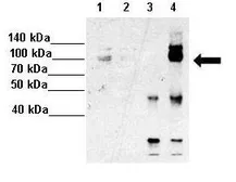 Anti-HNRPUL1 antibody, C-term used in Immunoprecipitation (IP). GTX49009