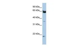 Anti-HOMEZ antibody, N-term used in Western Blot (WB). GTX49022