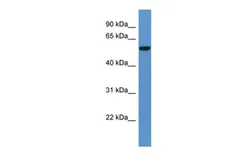 Anti-FCAMR antibody, C-term used in Western Blot (WB). GTX49051