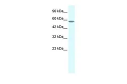 Anti-GTF2E1 antibody, C-term used in Western Blot (WB). GTX49059