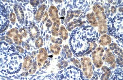 Anti-MYCBP antibody, Internal used in IHC (Paraffin sections) (IHC-P). GTX49061