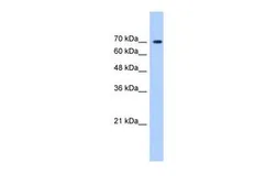 Anti-LAS1L antibody, C-term used in Western Blot (WB). GTX49067
