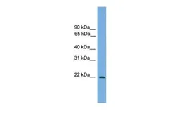 Anti-JDP2 antibody, N-term used in Western Blot (WB). GTX49080