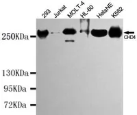 Anti-CHD4 antibody [5F1-A11-C9] used in Western Blot (WB). GTX49139