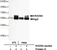 Anti-RAD9A antibody [3A3-A7-F8] used in Immunoprecipitation (IP). GTX49140