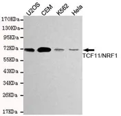 Anti-NRF1 antibody [9E6-H8-B6] used in Western Blot (WB). GTX49141
