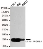 Anti-PGP9.5 antibody [7B8-G5-E7] used in Western Blot (WB). GTX49143
