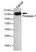 Anti-CD133 antibody [6H10-F1-C11] used in Western Blot (WB). GTX49150