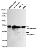 Anti-DR5 antibody [7F4-F8-G11] used in Western Blot (WB). GTX49151