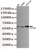 Anti-c-Fos antibody [7D6-A9-D4] used in Western Blot (WB). GTX49154