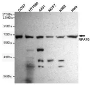 Anti-RPA70 antibody [8C3-D12-H10] used in Western Blot (WB). GTX49157
