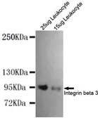 Anti-Integrin beta 3 antibody [3C12-G2-E4-H9] used in Western Blot (WB). GTX49161