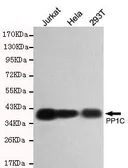 Anti-PP1C gamma antibody [2F2-A3-H10] used in Western Blot (WB). GTX49165