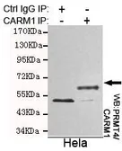 Anti-CARM1 antibody [2B9-H11-H10] used in Immunoprecipitation (IP). GTX49171