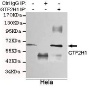 Anti-GTF2H1 antibody [3E8-D3-H8] used in Immunoprecipitation (IP). GTX49172