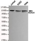 Anti-HDAC4 antibody [4A3-H7-C6] used in Western Blot (WB). GTX49181