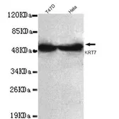 Anti-Cytokeratin 7 antibody [4G9-D8-H6] used in Western Blot (WB). GTX49182