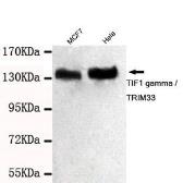 Anti-TIF1 gamma antibody [3H7-C8-B9] used in Western Blot (WB). GTX49184