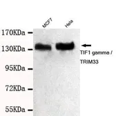 Anti-TIF1 gamma antibody [3H7-C8-B9] used in Western Blot (WB). GTX49184