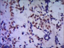 Anti-TBLR1 antibody [4F3-A8-D9] used in IHC (Paraffin sections) (IHC-P). GTX49189