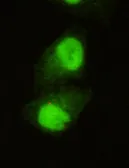 Anti-JARID1C antibody [2E4-E1-G8] used in Immunocytochemistry/ Immunofluorescence (ICC/IF). GTX49191
