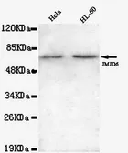 Anti-PSR antibody [3G5-G5-H8] used in Western Blot (WB). GTX49192
