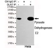 Anti-DLAT antibody [4A4-B6-C10] used in Immunoprecipitation (IP). GTX49202
