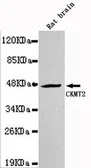Anti-CKMT2 antibody [3F4-G5-H5] used in Western Blot (WB). GTX49206
