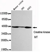 Anti-Creatine kinase MT antibody [1A6-C7-G10] used in Western Blot (WB). GTX49207