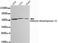 Anti-ALDH3A2 antibody [3F7-H9-E12] used in Western Blot (WB). GTX49209