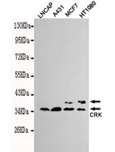 Anti-CRK antibody [3H7-E5-H8] used in Western Blot (WB). GTX49212
