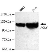 Anti-ATP citrate lyase antibody [3D9-E9-H8] used in Western Blot (WB). GTX49218