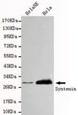 Anti-Syntenin 1 antibody [3D9-G9-H4] used in Western Blot (WB). GTX49226