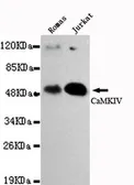 Anti-CaMKIV antibody [3C10-D5-G7] used in Western Blot (WB). GTX49228