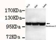 Anti-Hexokinase II antibody [1E8-H3-F11] used in Western Blot (WB). GTX49233