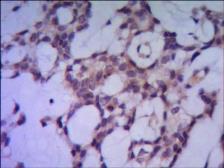 Anti-PPP1A antibody [1C11-C10-H5-E9] used in IHC (Paraffin sections) (IHC-P). GTX49238