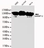 Anti-hnRNP U antibody [1B11-H2-B7] used in Western Blot (WB). GTX49242