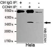 Anti-Cyclin H antibody [4E11-G2-D7] used in Immunoprecipitation (IP). GTX49246