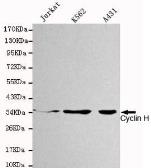 Anti-Cyclin H antibody [4E11-G2-D7] used in Western Blot (WB). GTX49246