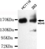 Anti-MSH6 antibody [3E1-B11-F12] used in Western Blot (WB). GTX49251