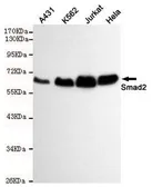 Anti-SMAD2 antibody [6H5-E3-C11] used in Western Blot (WB). GTX49263