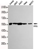 Anti-PPP5C antibody [2F2-F7-E8] used in Western Blot (WB). GTX49269