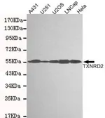 Anti-TXNRD2 antibody [3F2-E12-F10] used in Western Blot (WB). GTX49270