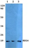 Anti-REG4 antibody used in Western Blot (WB). GTX49362