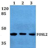 Anti-FRA2 antibody used in Western Blot (WB). GTX49376
