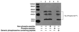 Anti-Tau (phospho Ser400) antibody used in Western Blot (WB). GTX49377